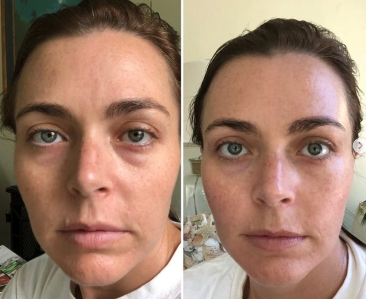 Amanda K. — before and after
